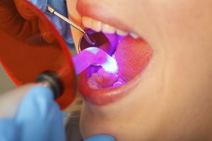 dentist inspecting woman's mouth with mirror and light