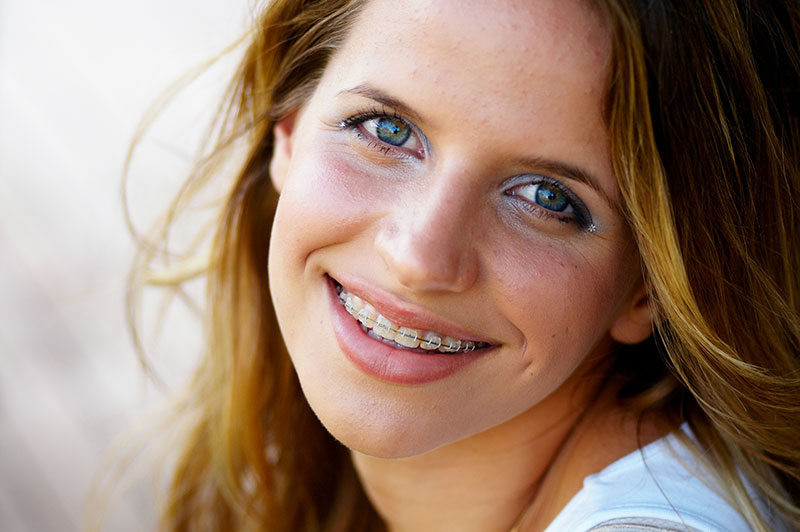 woman with braces smiling